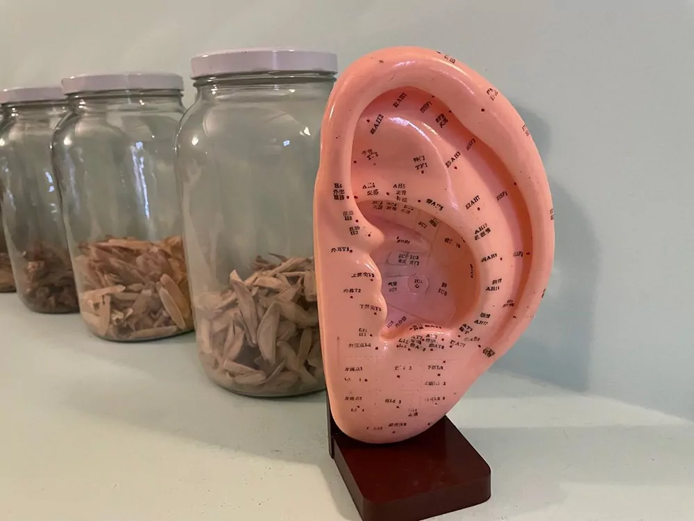 model of ear acupuncture