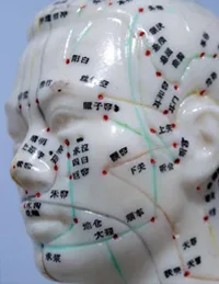 Acupuncture Gaining Acceptance in Urology