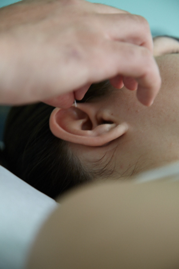 Acupuncture at ear points for pain