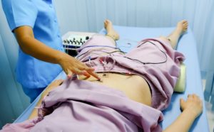 electroacupuncture on stomach