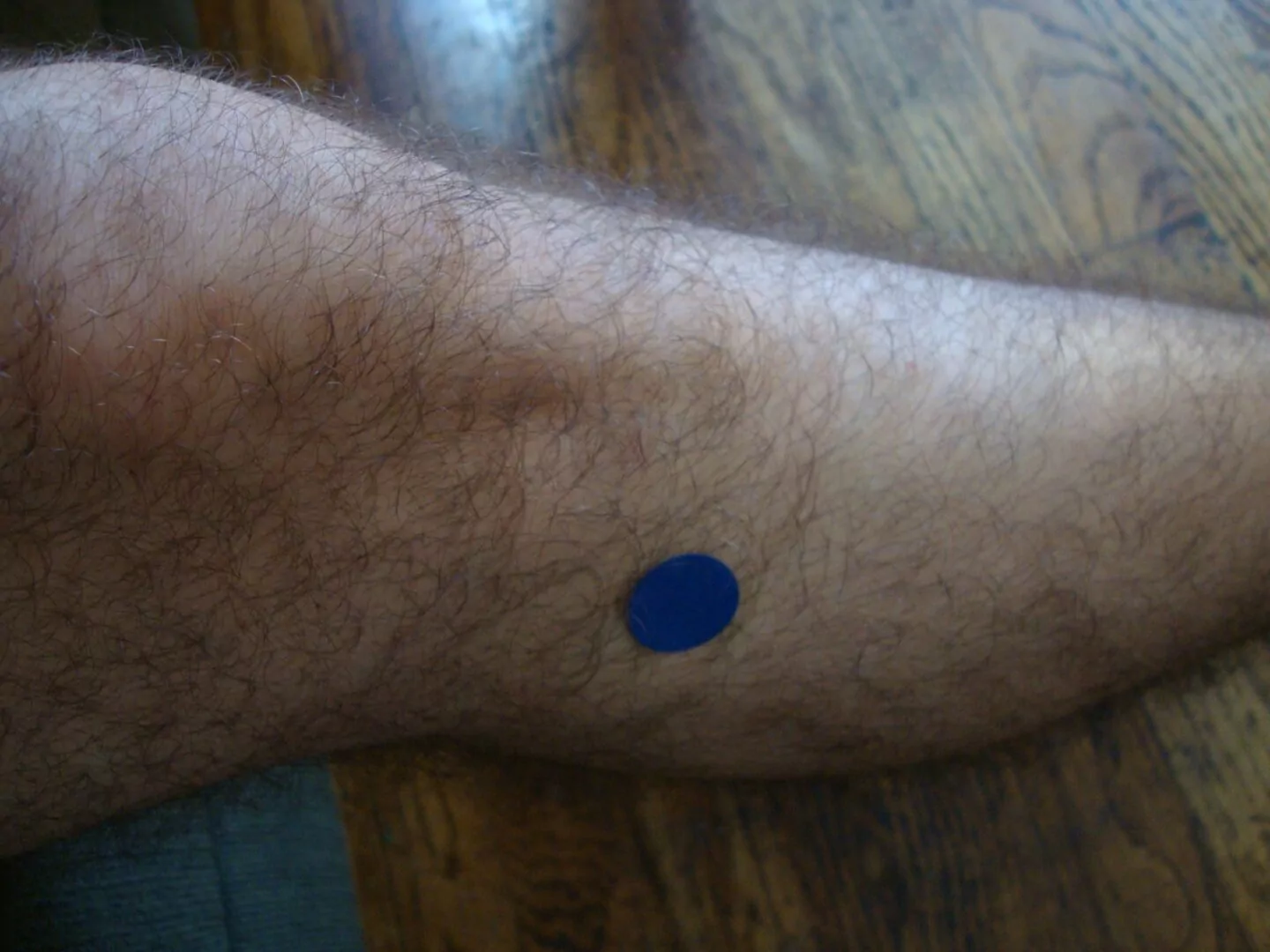 acupressure for headache