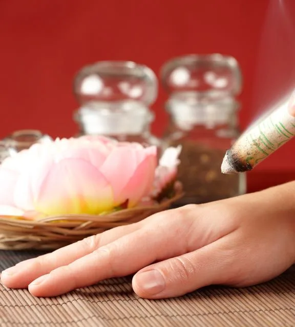 Moxibustion on Hand