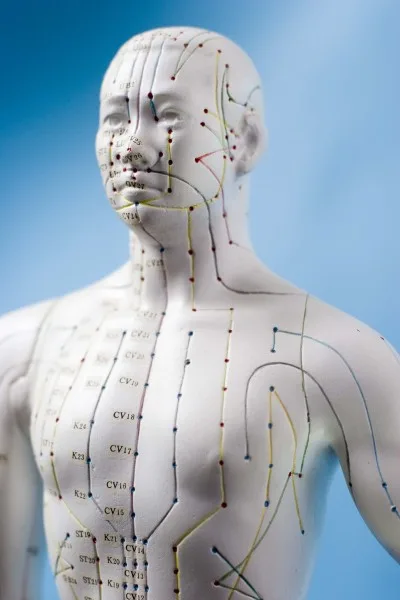 acupuncture model e1388423793151