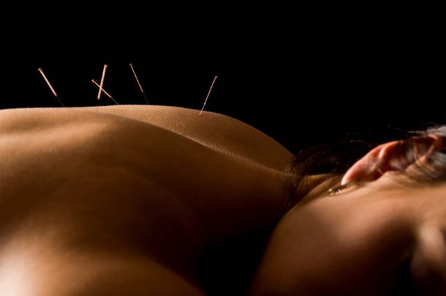 blog what goes into an acupuncture treatment copy 1