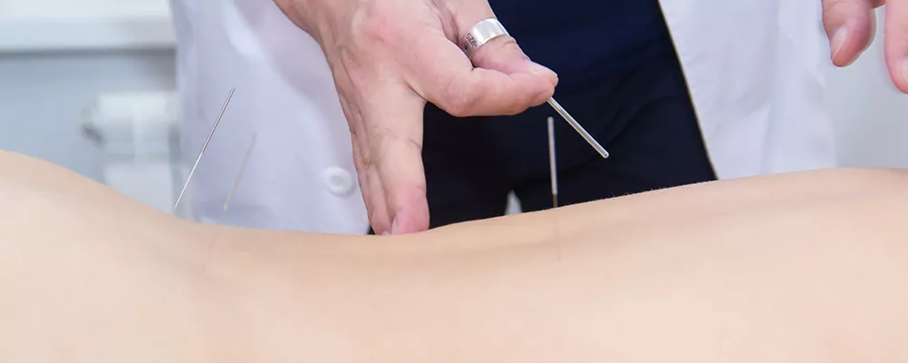Acupuncture for Pelvic Pain