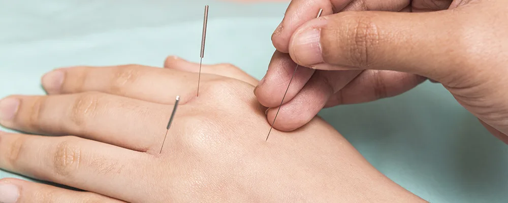 acupuncture for Tendonitis
