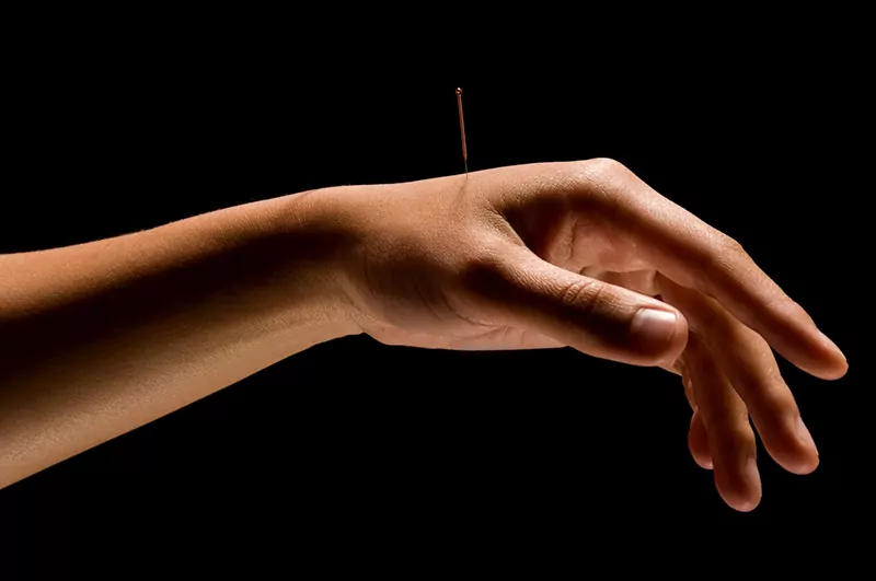 Acupuncture Treatment of Rosacea