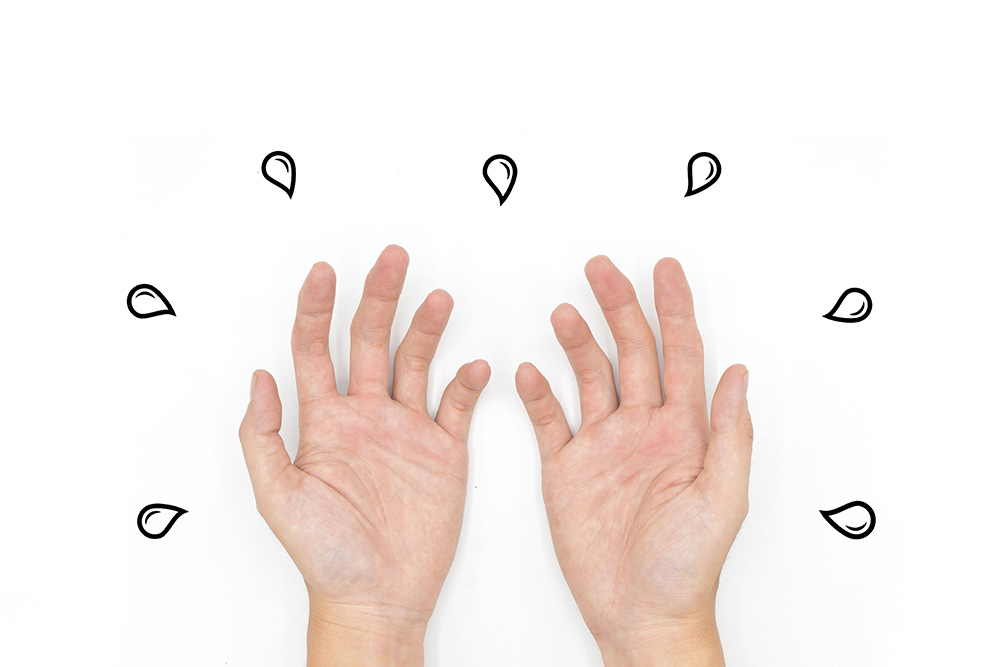 sweaty hands