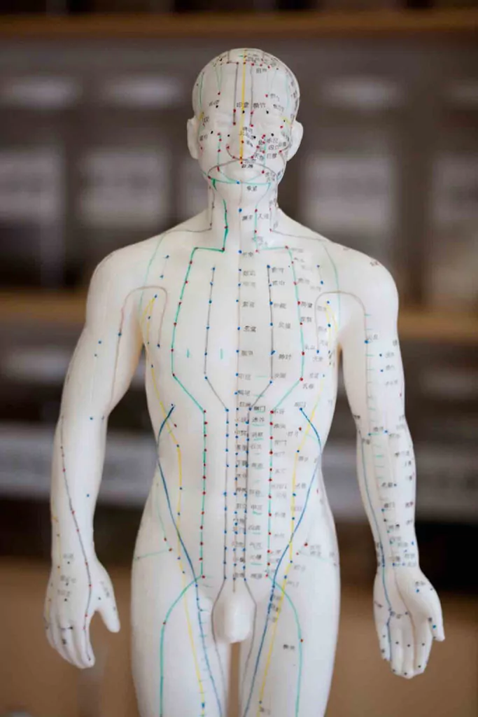 Acupuncture model