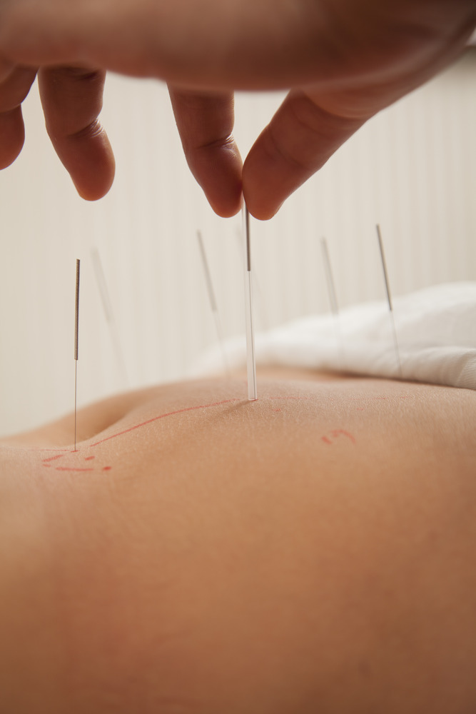 acupuncture on stomach