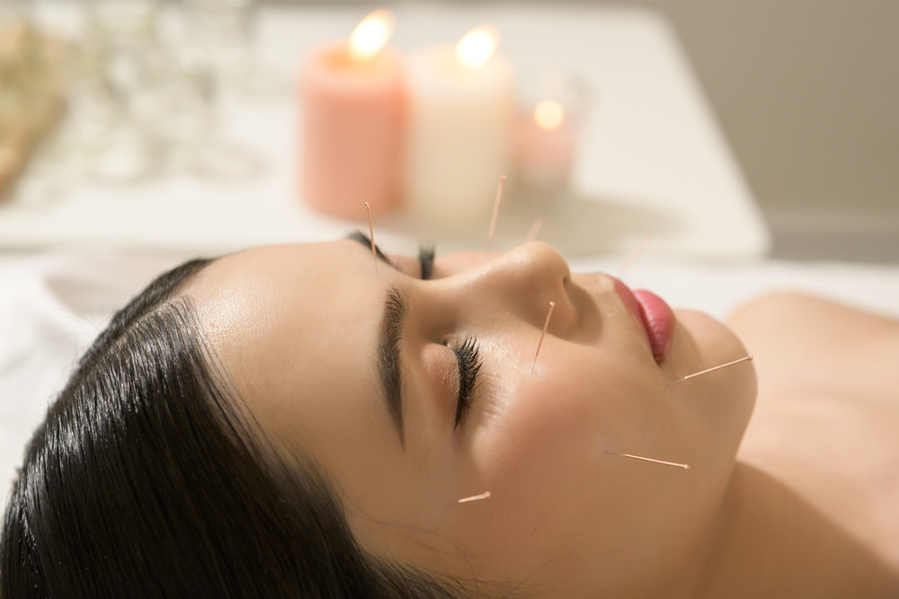 facial acupuncture side