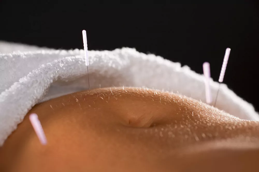 acupuncture on belly acupuncture on belly