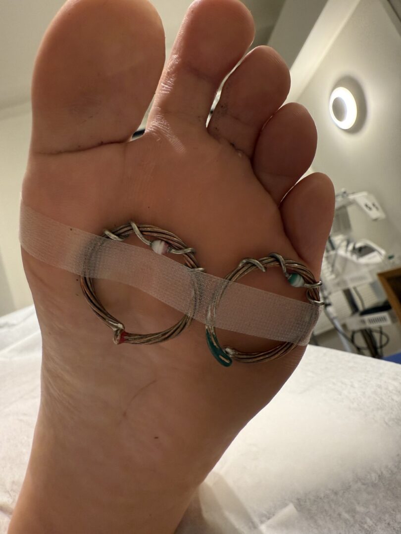 Diode ring on foot