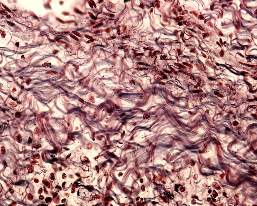 Fascia and Connective Tissue