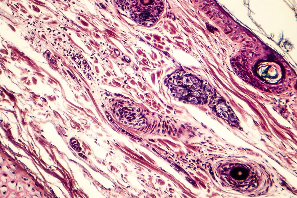 Fascia