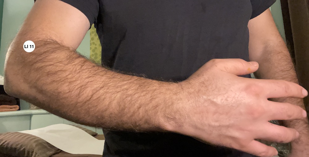 LI 11 arm